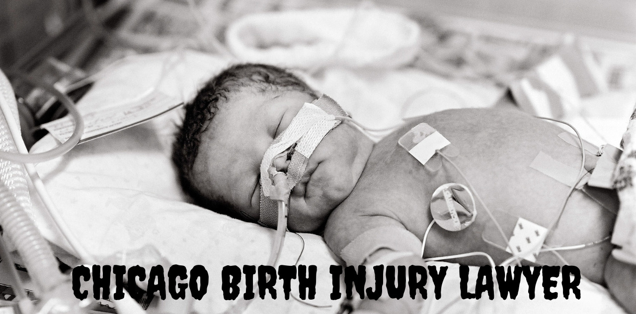 Chicago Birth Injury Lawyer Expertise Advocating for New Beginnings 2023